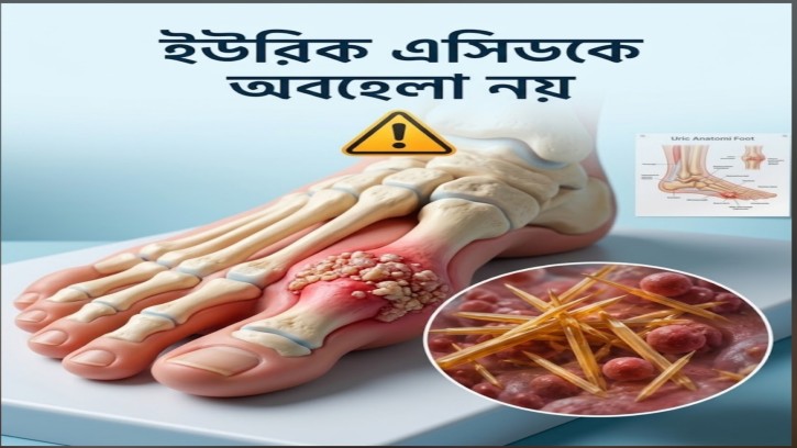 ইউরিক এসিডের মাত্রা বৃদ্ধি: অবহেলা ডেকে আনতে পারে পঙ্গুত্ব ও কিডনির মারাত্মক ক্ষতি