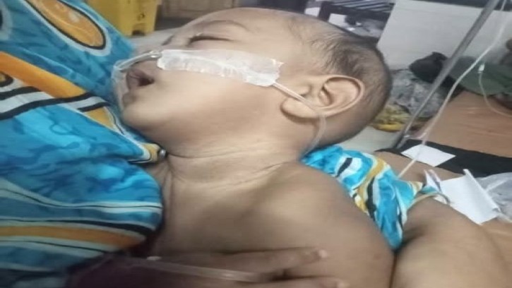 সাত মাসের আহাদকে বাঁচাতে সাহায্যের আকুতি, লাইফ সাপোর্টে শিশুটি